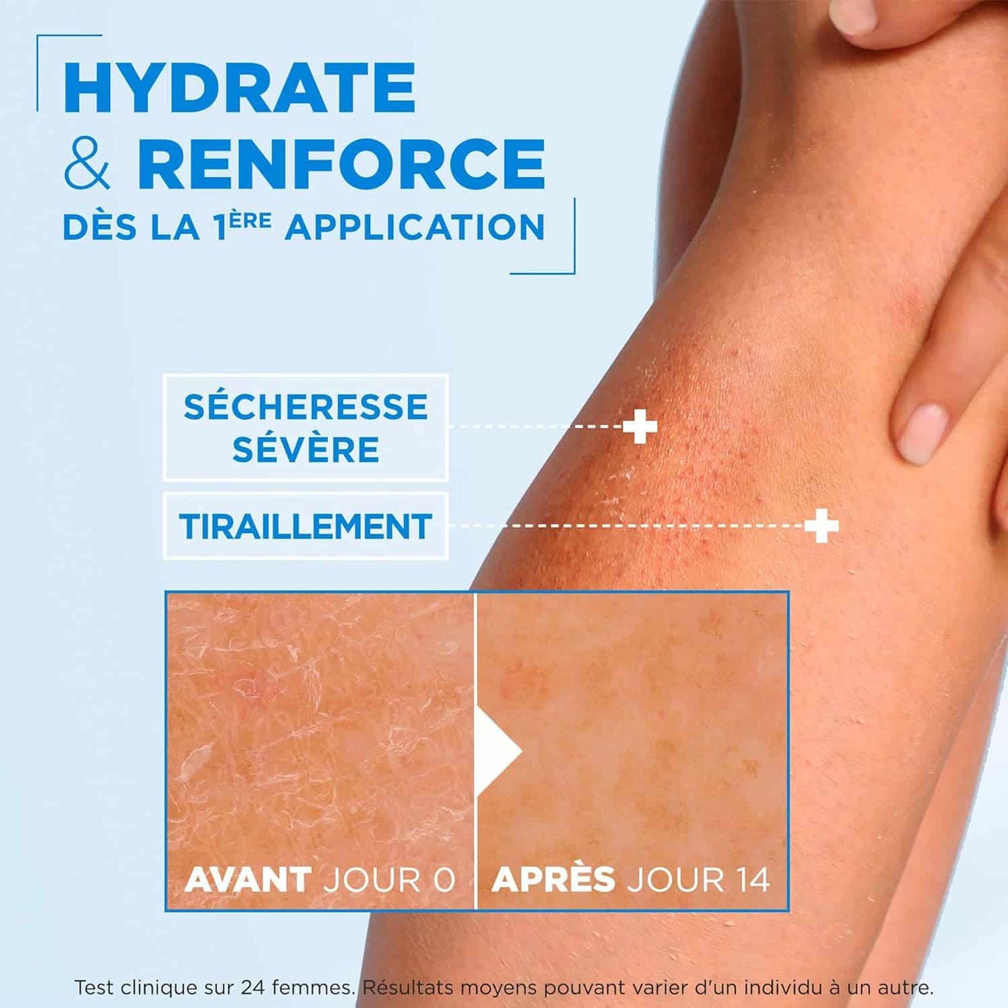 Mixa Expert Peau Sensible Crème Nourrissante Protectrice