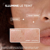 Mixa Sérum Concentré Anti-Taches Éclat 30ml