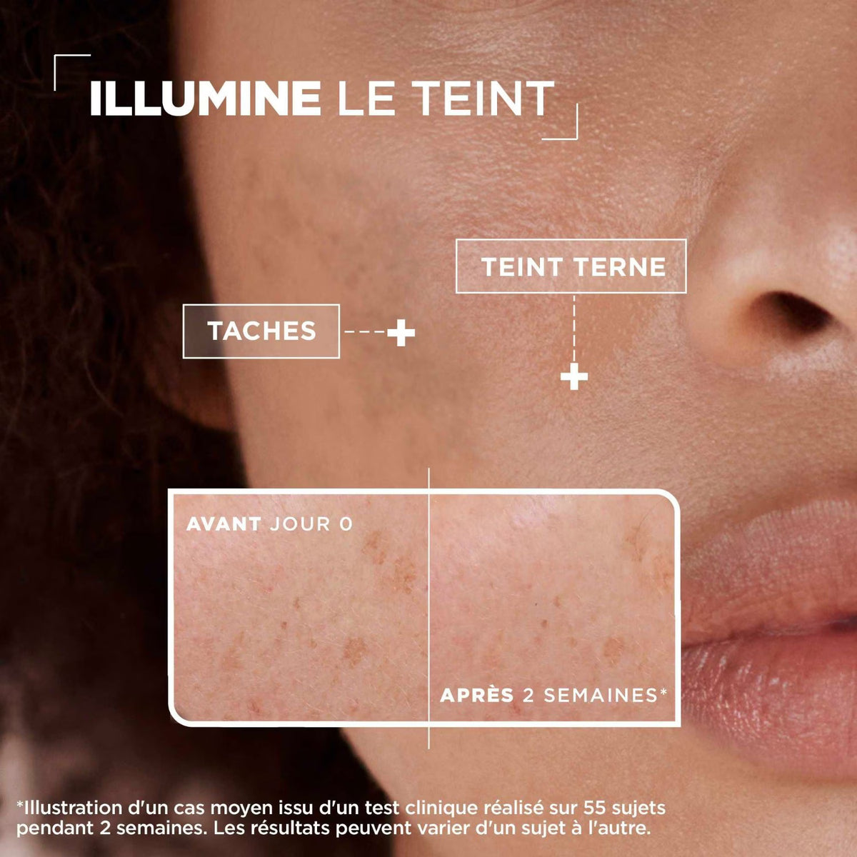 Mixa Sérum Concentré Anti-Taches Éclat 30ml