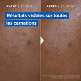 Mixa - Crème Niacinamide Correction Éclat - Visage, Corps et Mains - 400ml