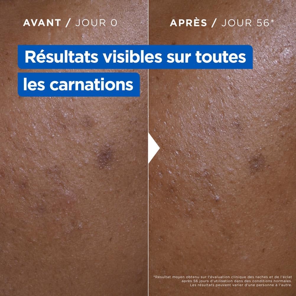 Mixa - Crème Niacinamide Correction Éclat - Visage, Corps et Mains - 400ml