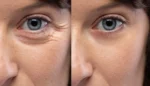 Versed Smooth Landing Advanced Retinoid Baume Contour Yeux – Image 3